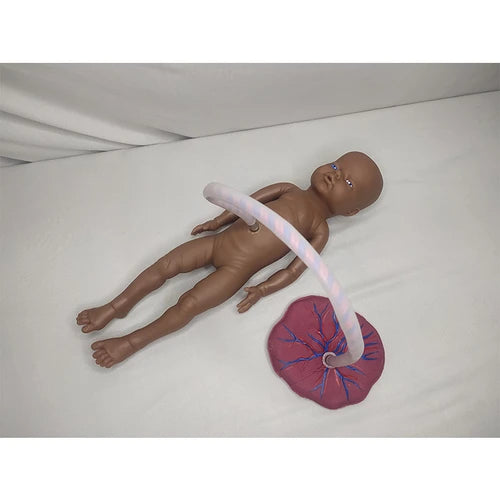 Baby with Placenta and Umbilical Cord