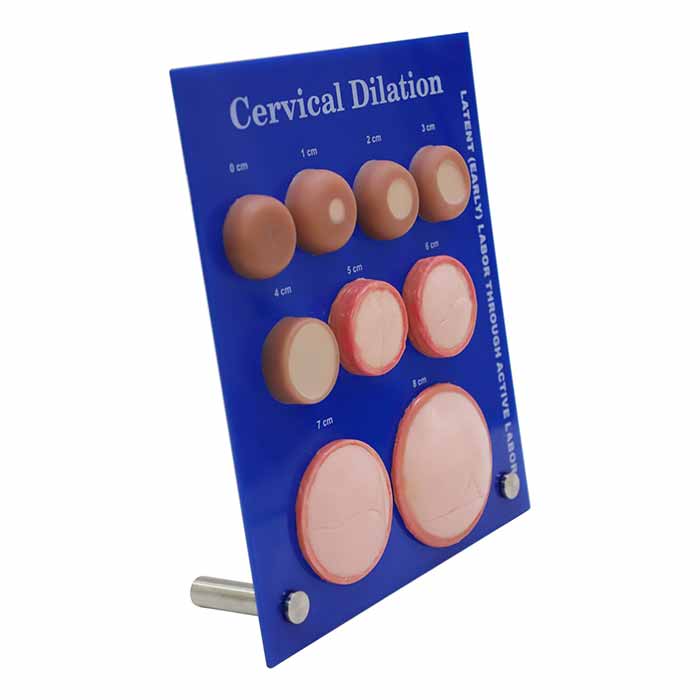 Cervical Dialation Model
