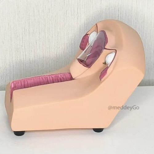 IUD Training Skin Model
