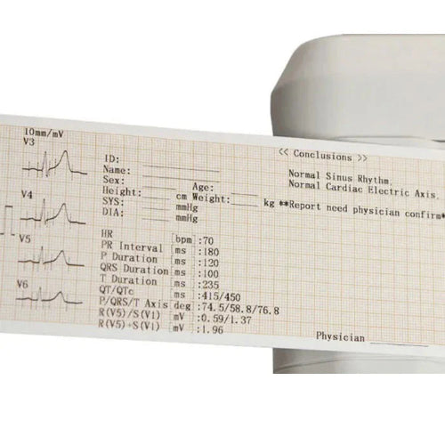 3 Channel ECG Machine with High Quality Waveforms
