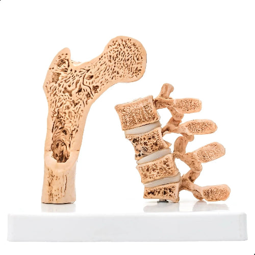 osteoporotic vertebral