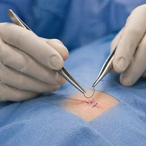 vicryl sutures
