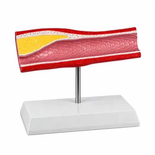 artery model delux