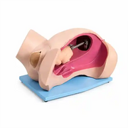 delivery model