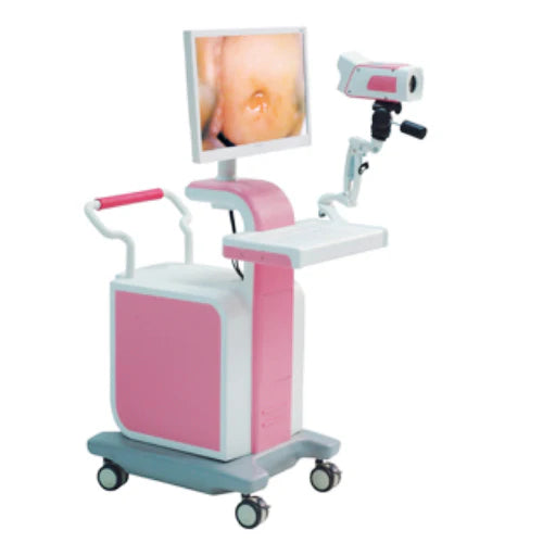 Digital Video HD Colposcope
