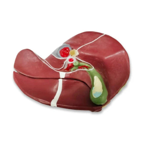 Diseased Liver Model (Small)