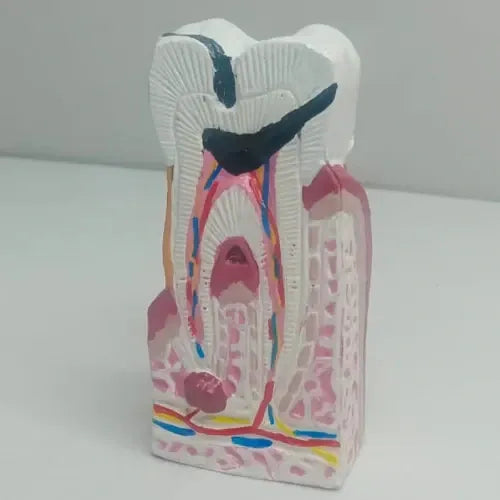 diseased tooth model