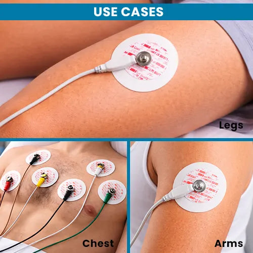 disposable ecg electrodes