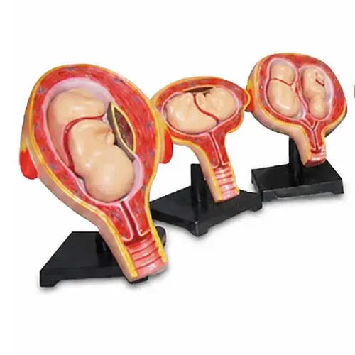 embryo set
