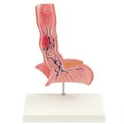 esophagus model