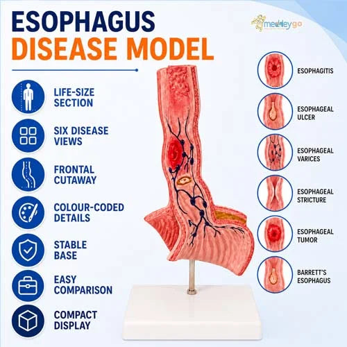 esophagus model