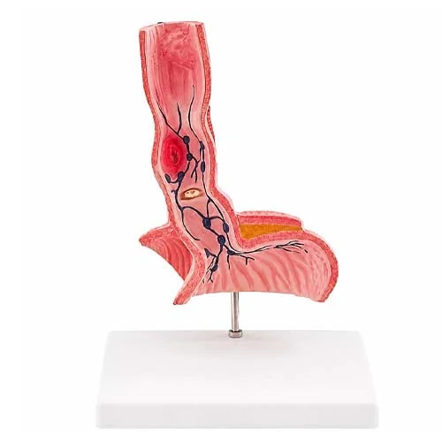 esophagus model