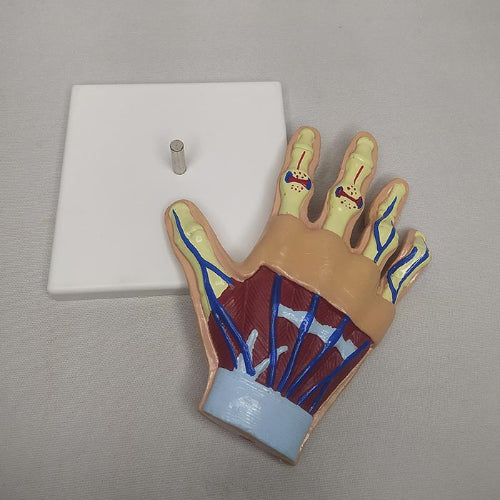Hand Arthritis Model Delux