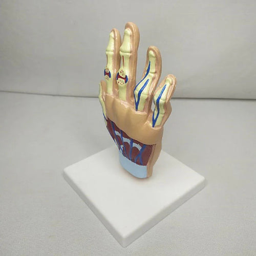 Hand Arthritis Model Delux