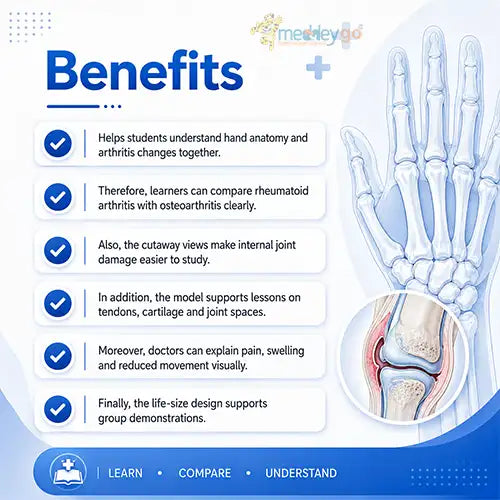 hand arthritis model