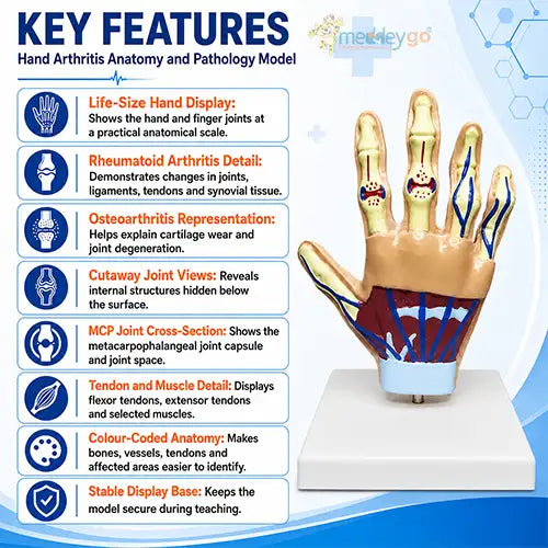 hand arthritis model