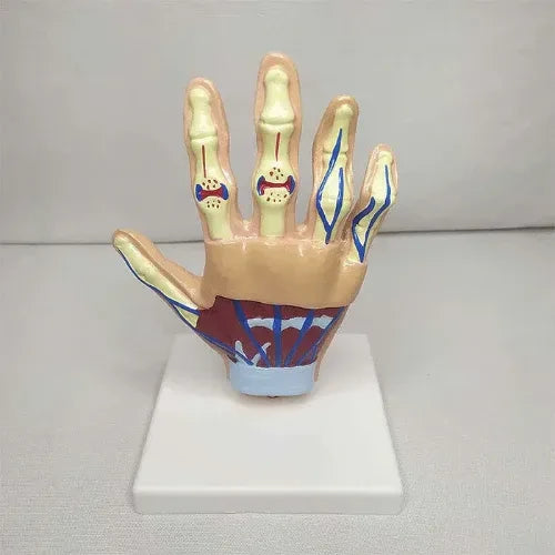 hand arthritis model
