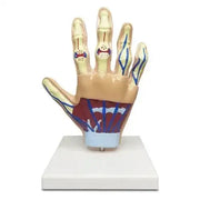 hand arthritis model 