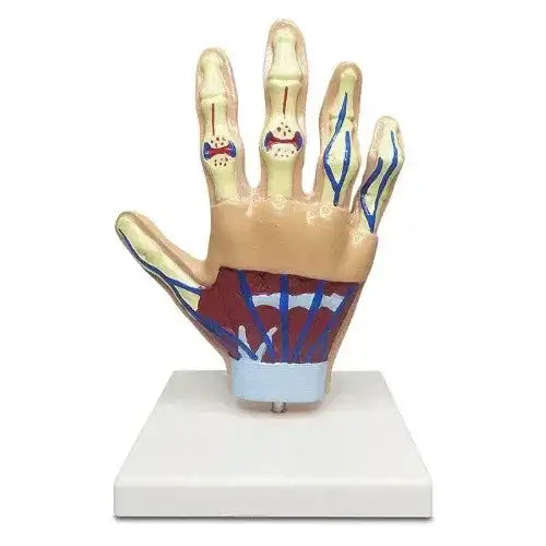 hand arthritis model 