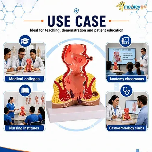  hemorrhoids anatomy 