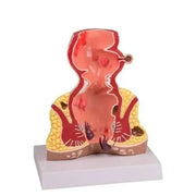  hemorrohids anatomy 