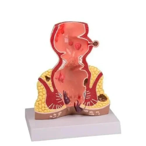  hemorrohids anatomy 