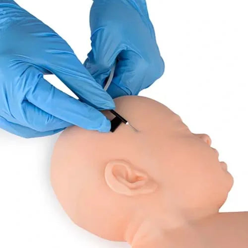 infant scalp intravenous