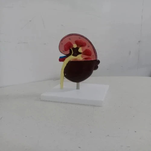 kidney cyst model
