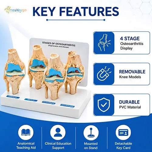 knee joint model 