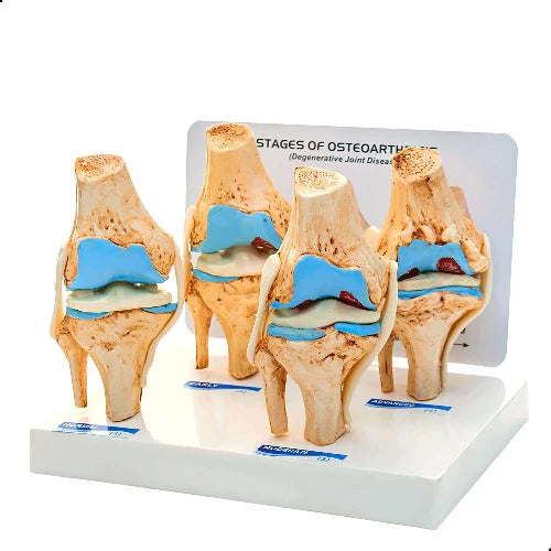 knee joint model