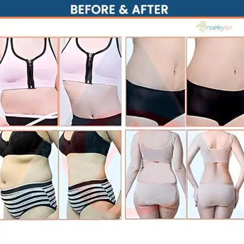 laser i lipo
