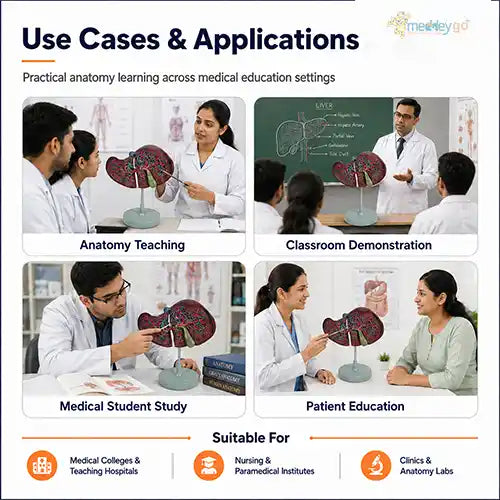liver model