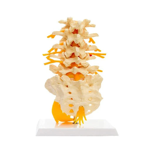 Lumbar Sacrum Spine Model with Herniated DIsc