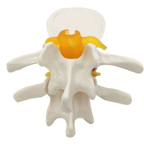 lumbar disc  spine
