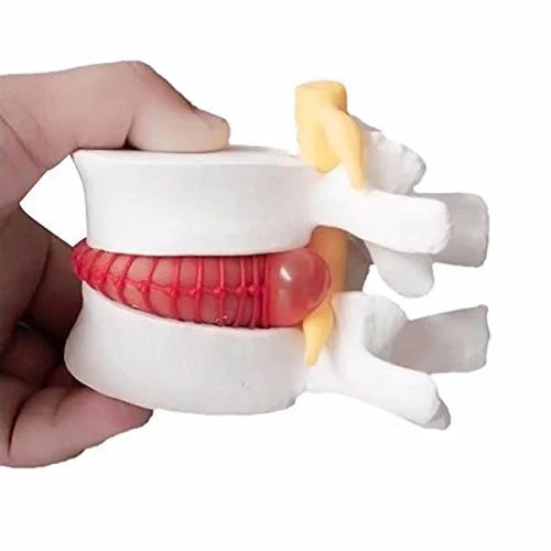 lumbar disc  spine