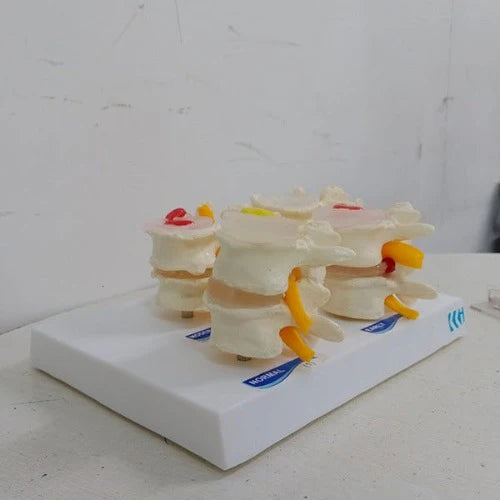 lumbar vertebrae degeneration model