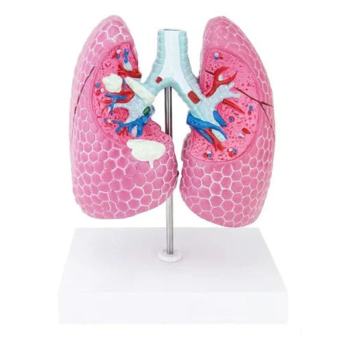 lung pathological model