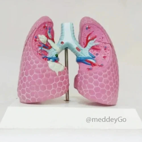 lung pathological model