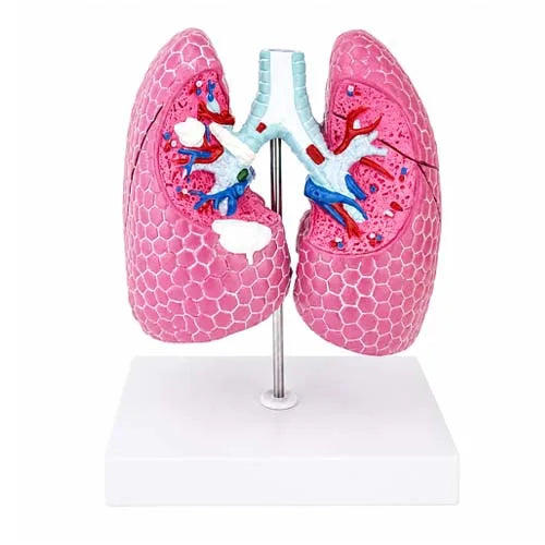 lung pathological model