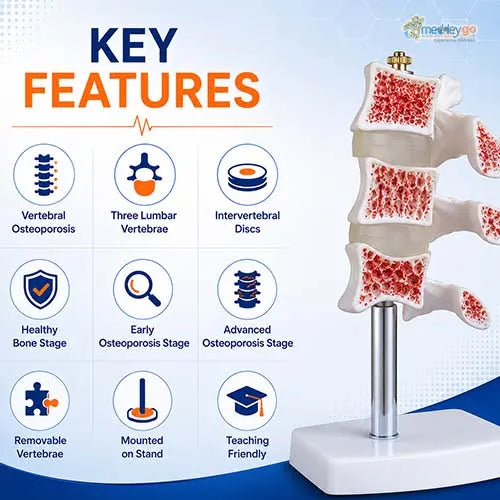 osteoporosis model