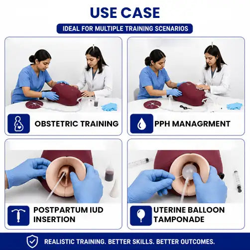 postpartum uterus trainer use cses