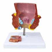 rectum model 