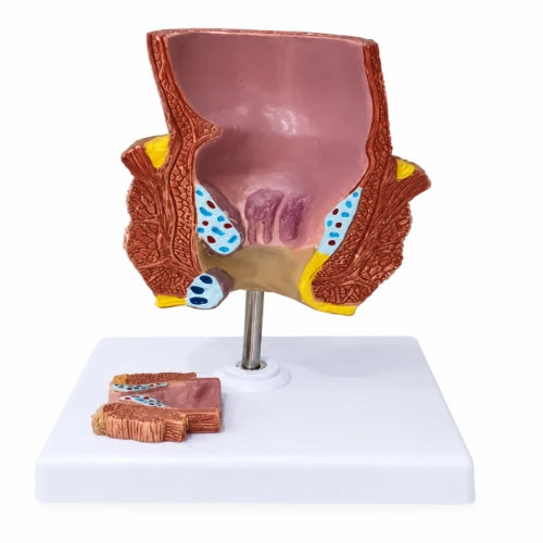 rectum model 