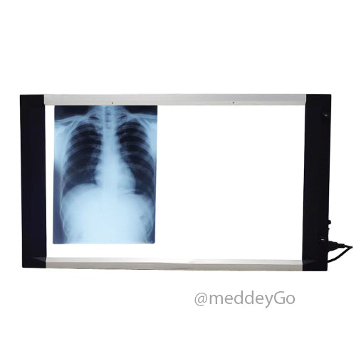 Slim LED X Ray View Box 25mm Thickness With Dimmer  Sensor - Double Film