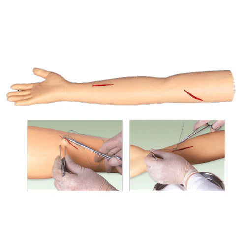 suture arm