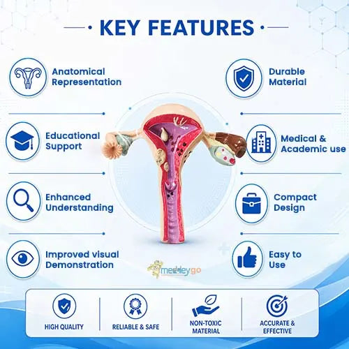 uterus anatomical model