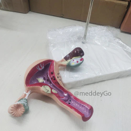 Uterus Anatomical Model Delux Quality